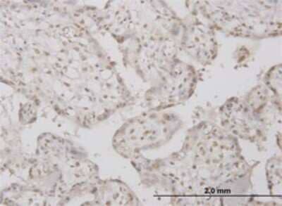 Immunohistochemistry-Paraffin: PP1 Inhibitor-2 Antibody (2E9) [H00005504-M01]