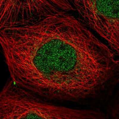 Immunocytochemistry/ Immunofluorescence: PP1 Inhibitor-2 Antibody [NBP2-48801]