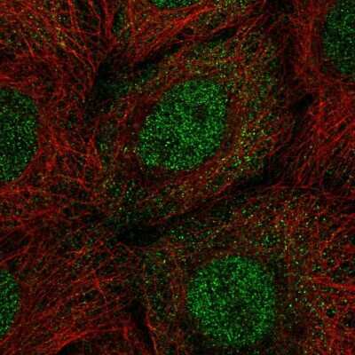 Immunocytochemistry/ Immunofluorescence: PP1 Inhibitor-2 Antibody [NBP2-56881]