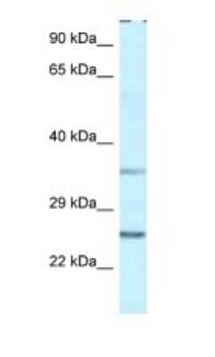 Western Blot: PP1 Inhibitor-2 Antibody [NBP1-79889]