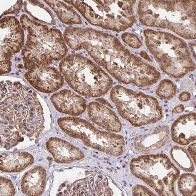Immunohistochemistry-Paraffin: PP1 alpha/PPP1A Antibody [NBP2-38559]