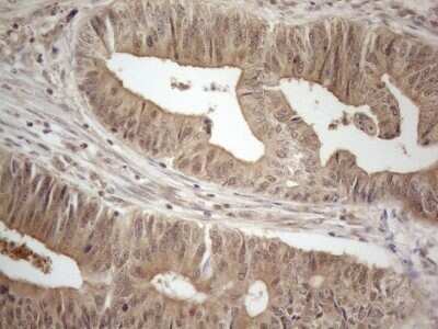 Immunohistochemistry: PP1 alpha/PPP1A Antibody (OTI6E5) - Azide and BSA Free [NBP2-73542]