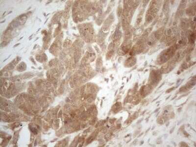 Immunohistochemistry: PP1 alpha/PPP1A Antibody (OTI6E5) - Azide and BSA Free [NBP2-73542]