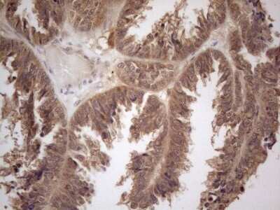 Immunohistochemistry: PP1 alpha/PPP1A Antibody (OTI6E5) - Azide and BSA Free [NBP2-73542]