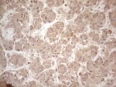 Immunohistochemistry: PP1 alpha/PPP1A Antibody (OTI6E5) - Azide and BSA Free [NBP2-73542]