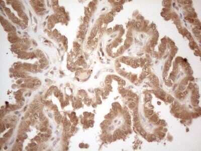 Immunohistochemistry: PP1 alpha/PPP1A Antibody (OTI6E5) - Azide and BSA Free [NBP2-73542]