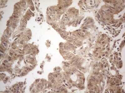Immunohistochemistry: PP1 alpha/PPP1A Antibody (OTI6E5) - Azide and BSA Free [NBP2-73542]