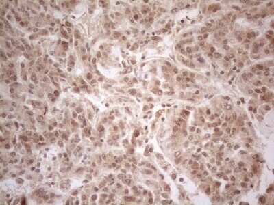 Immunohistochemistry: PP1 alpha/PPP1A Antibody (OTI6E5) - Azide and BSA Free [NBP2-73542]