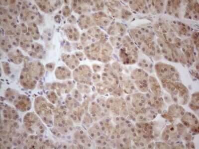 Immunohistochemistry: PP1 alpha/PPP1A Antibody (OTI6E5) - Azide and BSA Free [NBP2-73542]