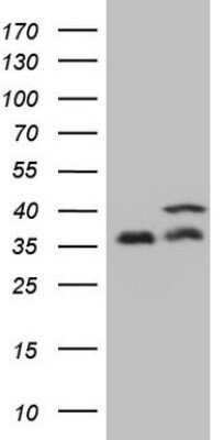 Western Blot: PP1 alpha/PPP1A Antibody (OTI6E5)Azide and BSA Free [NBP2-73542]