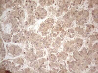 Immunohistochemistry-Paraffin: PP1 alpha/PPP1A Antibody (OTI6E5) [NBP2-45384]