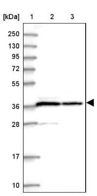 Western Blot: PP1 alpha/PPP1A Antibody [NBP2-38559]