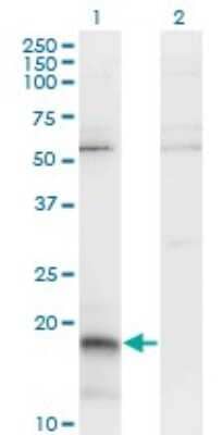 Western Blot: PP14/Glycodelin Antibody (6G2) [H00005047-M01]