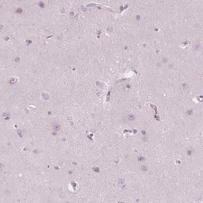 Immunohistochemistry-Paraffin: PP14/Glycodelin Antibody [NBP1-89782]