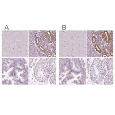 Immunohistochemistry-Paraffin: PP14/Glycodelin Antibody [NBP1-89782]