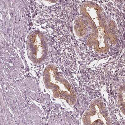Immunohistochemistry-Paraffin: PP14/Glycodelin Antibody [NBP1-89782]