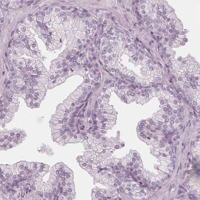 Immunohistochemistry-Paraffin: PP14/Glycodelin Antibody [NBP1-89782]