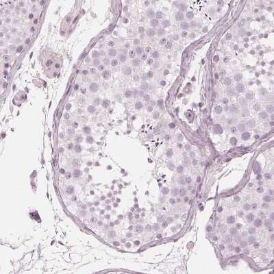 Immunohistochemistry-Paraffin: PP14/Glycodelin Antibody [NBP1-89782]