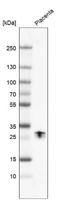 Western Blot: PP14/Glycodelin Antibody [NBP1-89781]