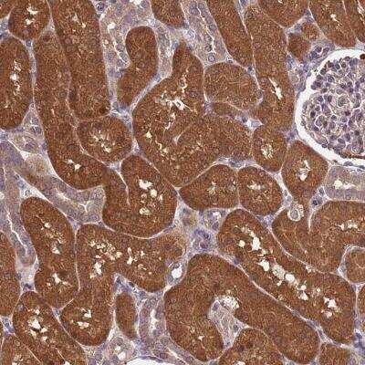 Immunohistochemistry: PP2A alpha Antibody [NBP2-46693]