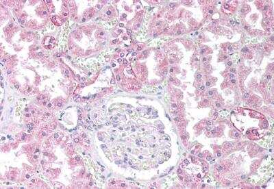 Immunohistochemistry-Paraffin: PP2A alpha Antibody [NB100-844]