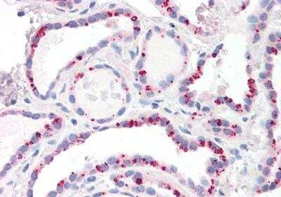 Immunohistochemistry-Paraffin: PP2A alpha Antibody [NB100-844]