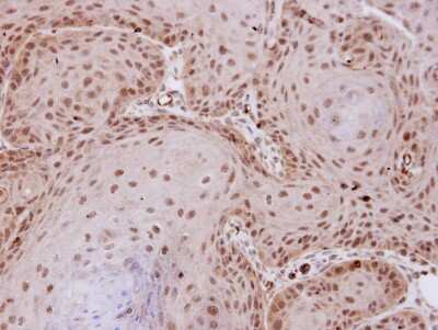 Immunohistochemistry-Paraffin: PP2A alpha Antibody [NBP2-19896]