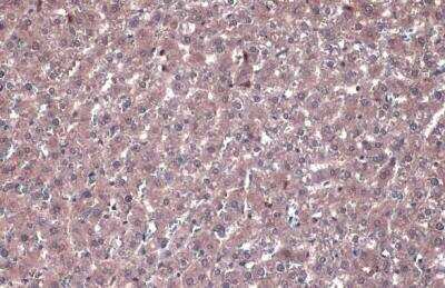 Immunohistochemistry-Paraffin: PP2A alpha Antibody [NBP2-19896]