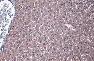 Immunohistochemistry-Paraffin: PP2A alpha Antibody [NBP2-19896]