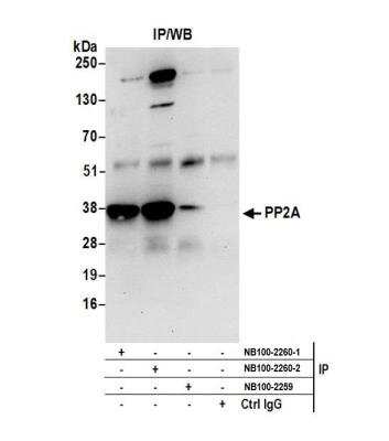 Immunoprecipitation: PP2A alpha Antibody [NB100-2260]