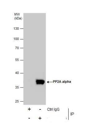 Immunoprecipitation: PP2A alpha Antibody [NBP1-31266]