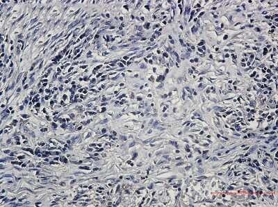Immunohistochemistry-Paraffin: PP2A alpha/beta Antibody (S04-4G4) [NBP3-15081]