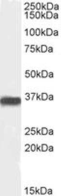 Western Blot: PP2A alpha Antibody [NB100-844]