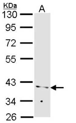 Western Blot: PP2A alpha Antibody [NBP2-19896]