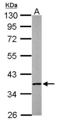 Western Blot: PP2A alpha Antibody [NBP2-19896]