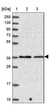 Western Blot: PP2A alpha Antibody [NBP2-46693]