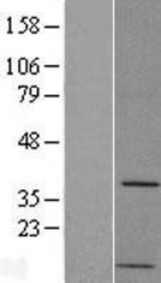 Western Blot: PP2A alpha Overexpression Lysate [NBL1-14689]