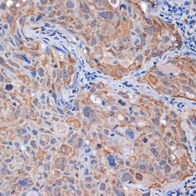 Immunohistochemistry-Paraffin: PP2A alpha/beta Antibody (4J2Z8) [NBP3-16634]