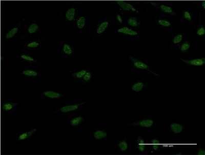 Immunocytochemistry/ Immunofluorescence: PP2C alpha/PPM1A Antibody (4E11) [H00005494-M03]