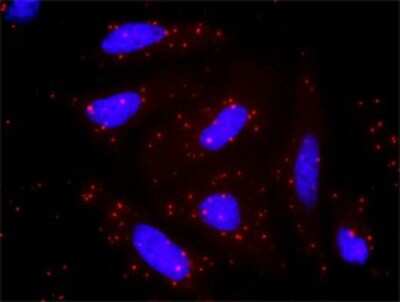 Proximity Ligation Assay: PP2C alpha/PPM1A Antibody (4E11) [H00005494-M03]