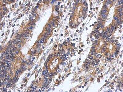 Immunohistochemistry-Paraffin: PP2C alpha/PPM1A Antibody [NBP1-32751]