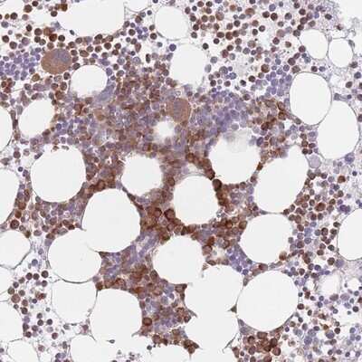 Immunohistochemistry-Paraffin: PP2C alpha/PPM1A Antibody [NBP2-13796]