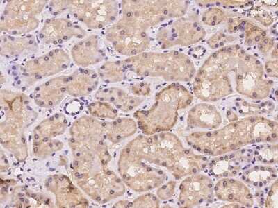 Immunohistochemistry-Paraffin: PP2C alpha/PPM1A Antibody [NBP2-97170]