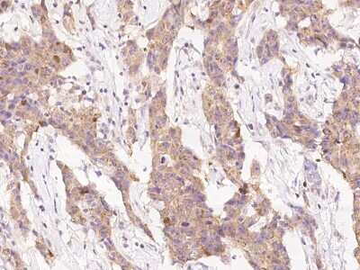 Immunohistochemistry-Paraffin: PP2C alpha/PPM1A Antibody [NBP3-00058]