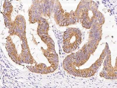 Immunohistochemistry-Paraffin: PP2C alpha/PPM1A Antibody [NBP3-00058]