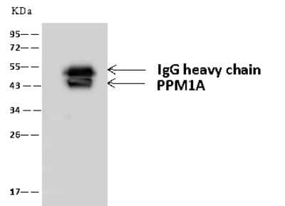 Immunoprecipitation: PP2C alpha/PPM1A Antibody [NBP3-00058]