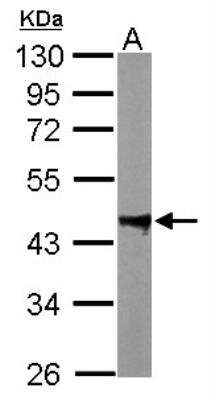 Western Blot: PP2C alpha/PPM1A Antibody [NBP1-32751]