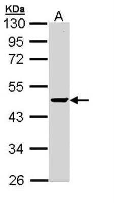 Western Blot: PP2C alpha/PPM1A Antibody [NBP1-32751]