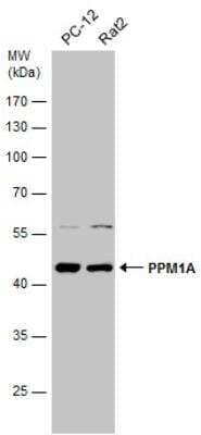 Western Blot: PP2C alpha/PPM1A Antibody [NBP1-32751]