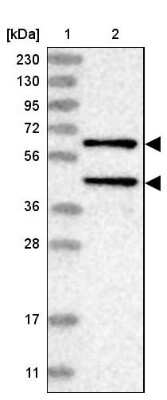 Western Blot: PP2C alpha/PPM1A Antibody [NBP2-13796]